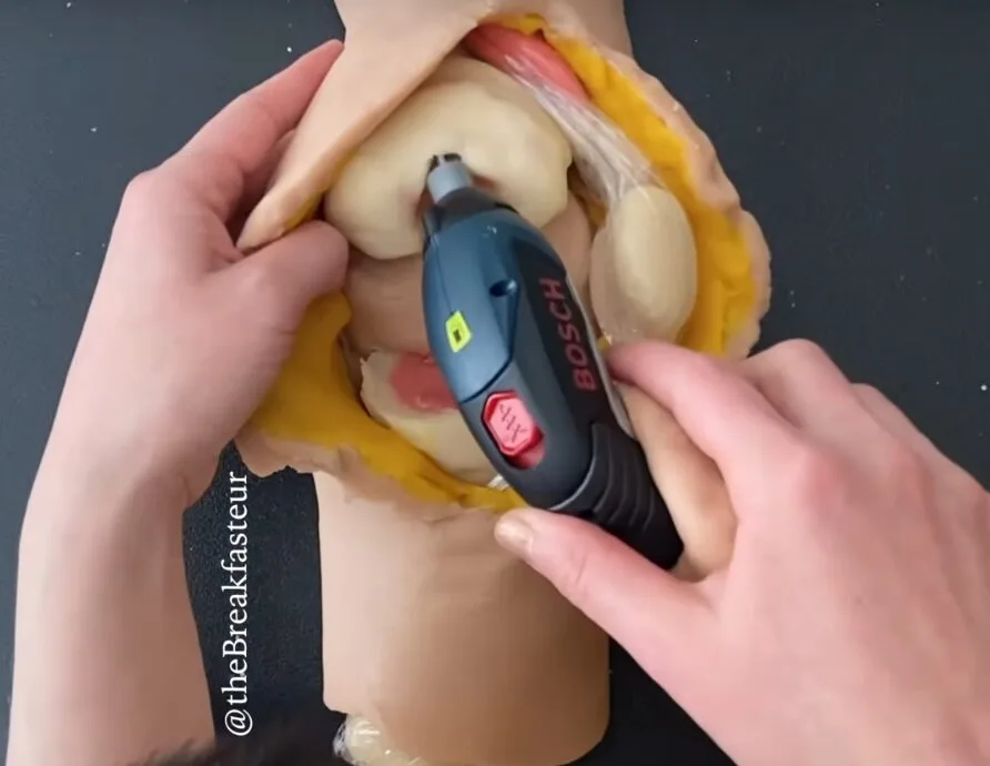Mãe cirurgiã faz cirurgias complexas junto com o filho, usando massinha