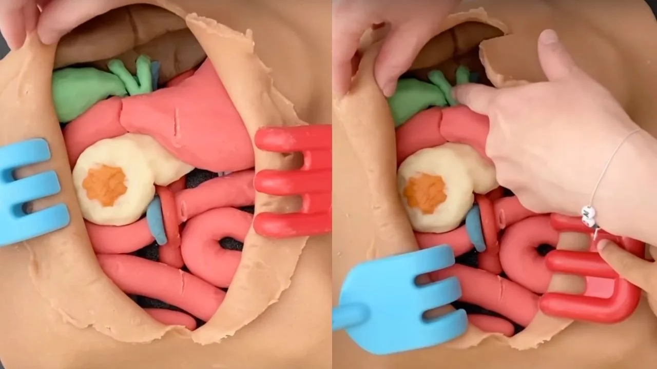 Mãe cirurgiã faz cirurgias complexas junto com o filho, usando massinha