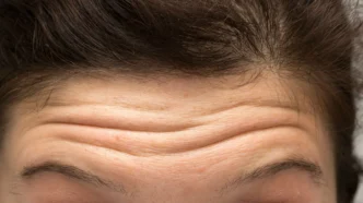 Rugas e linhas de expressão na testa feminina